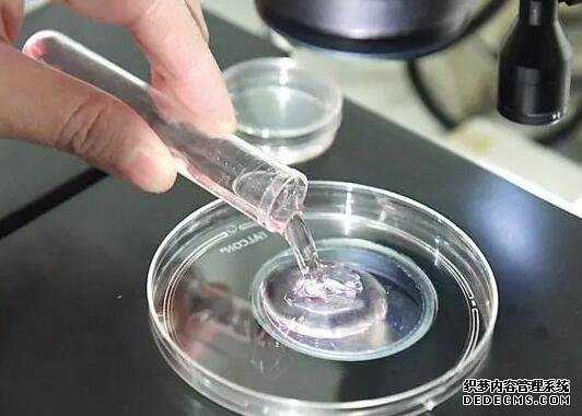 精子筛选和试管的区别_试管能选性别me_二代试管优质胚胎养囊成功率高吗？